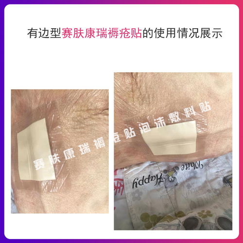 医用褥疮贴预防压疮赛肤康瑞有边型心形减压自粘泡沫敷料伤口护理